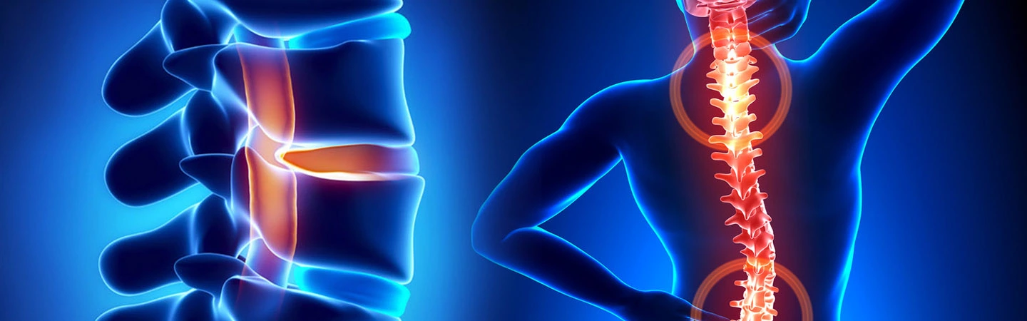 Hernia Care